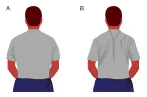 Overcome lower back pain by stretch exersises
